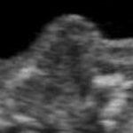 Faut-il autoriser la gestation pour autrui ?