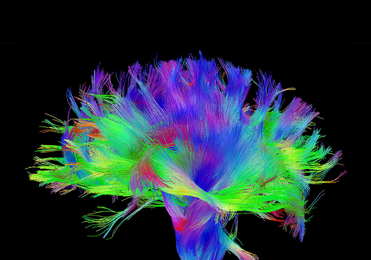 Neurosciences : l&rsquo;intelligence peut-elle être artificielle ?